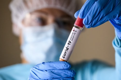 A Bahia registra 387 novos casos de Covid-19 e mais 27 óbitos
