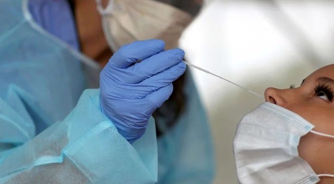 Fiocruz pode fabricar 60 milhões de testes de antígeno para covid-19