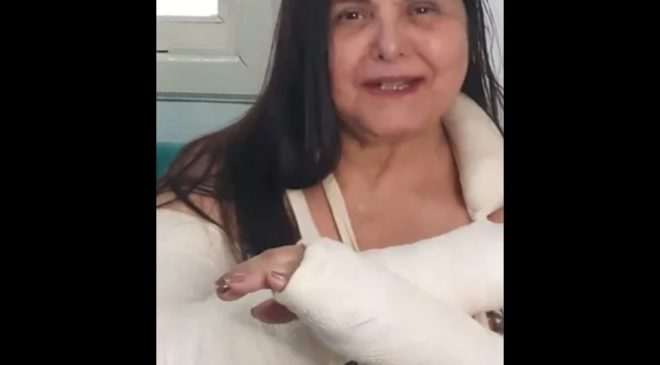 Atriz Elizangela sofre acidente em casa e surge com braços enfaixados em vídeo. Veja!