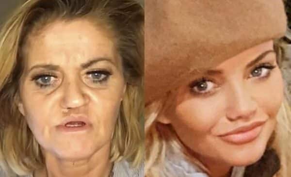 Atriz que teve rosto corroído por uso de cocaína aparece irreconhecível