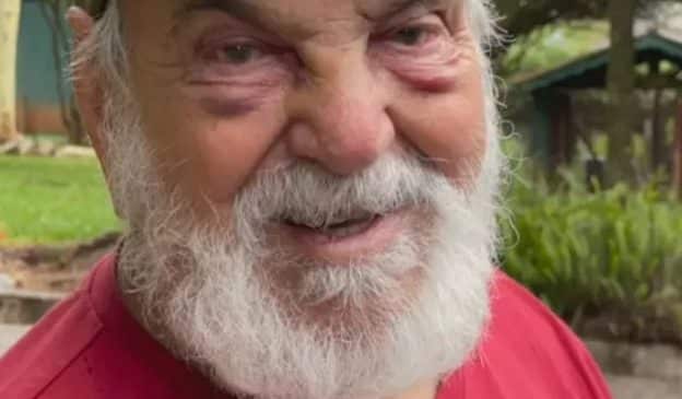 Lima Duarte mostra rosto machucado e assusta fãs. Saiba o que aconteceu com ator