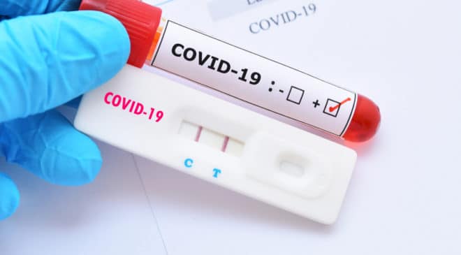 Boletim epidemiológico da Covid-19. Bahia registra 9 óbitos, sistemas do Ministério da Saúde permanecem indisponíveis