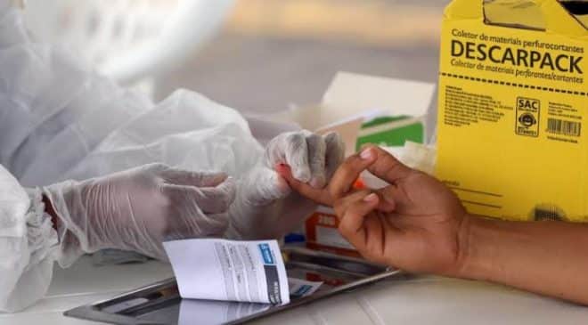Lacen registra aumento de 234% para casos de Covid-19