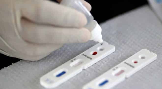 Anvisa determina recolhimento de autoteste de covid-19 e avisa; “até o momento, não existe nenhum produto aprovado como autoteste, ou seja, para uso por usuários leigos”