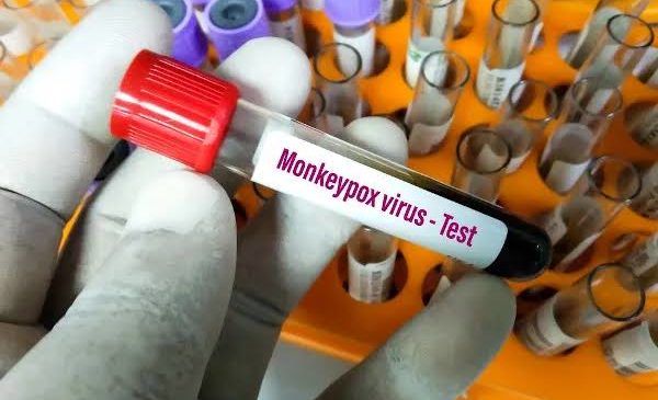 Confirmado mais um caso de Monkeypox na Bahia