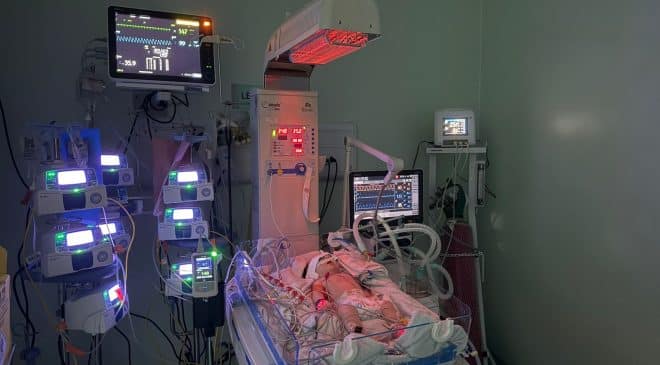 Bebê supera quadro gravíssimo e deixa UTI neonatal sem sequelas em Feira